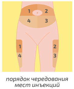 Схемы чередования мест введения инсулина.Диабет, сахарный диабет, СД1 типа, СД 2 типа, Правило 15.