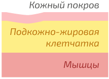 МЕСТА ИНЪЕКЦИЙ ИНСУЛИНА.Диабет, сахарный диабет, СД1 типа, СД 2 типа, Правило 15.