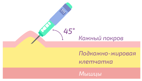 Игла 8–13 мм.Диабет, сахарный диабет, СД1 типа, СД 2 типа, Правило 15.